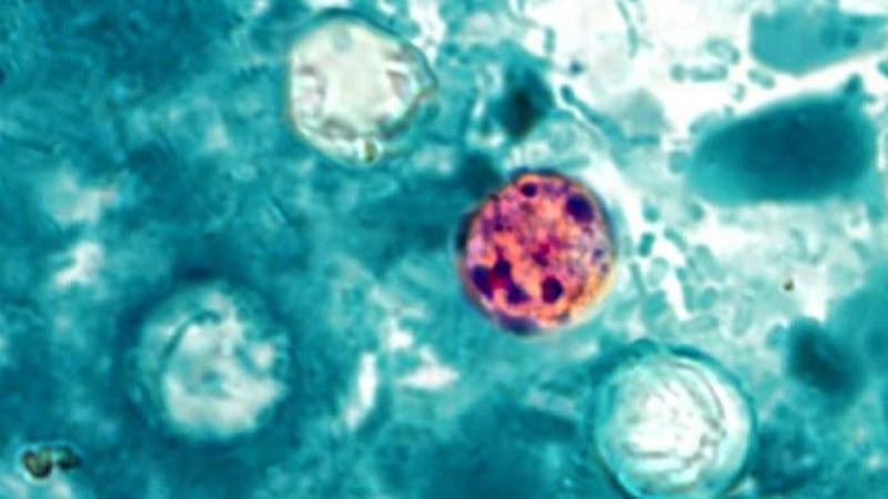 The tiny parasite called Cyclospora is making people sick across the country.