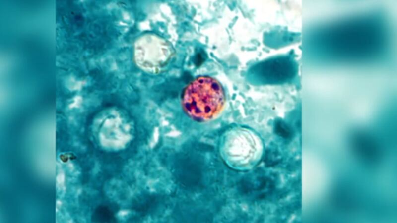 The parasite cyclospora which causes Cyclosporiasis